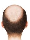 Bald men head Royalty Free Stock Photo