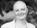 Bald woman - cancer survivor Royalty Free Stock Photo