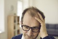 Balding middle aged man concerned about hair loss touches bald spots on his head Royalty Free Stock Photo