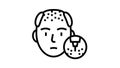 baldness disease line icon animation