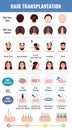 Baldness Hair Transplantation Set Royalty Free Stock Photo