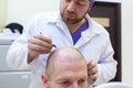 Baldness treatment. Patient suffering from hair loss in consultation with a doctor. Preparation for hair transplant