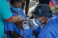 BALI/INDONESIA-MAY 28 2021: An ENT doctor is examining the ears, nose and throat of a pediatric patient. During the COVID-19