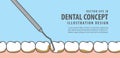 Banner Scaling teeth illustration vector on blue background. Den
