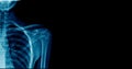 Banner shoulder x-ray Royalty Free Stock Photo