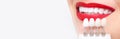 Banner tooth whitening, perfect white teeth red lips mouth close up with shade guide bleach color, female veneer smile