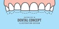 Banner Upper attrition Bruxism teeth illustration vector on bl