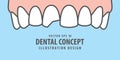 Banner Upper Chipped tooth illustration vector on blue background. Dental concept.