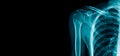 Banner x-ray shoulder Royalty Free Stock Photo