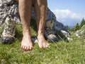 Bare feet and legs with Varicose Veins of tourist hiker