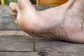 Bare foot stepping on a sharp rusty nail from a weathered wooden board, soft focus close up Royalty Free Stock Photo
