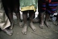 Barefoot african children