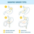 Bariatric surgery weight loss procedure types infographics
