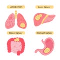 Cancer types flat illustration.