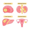 Cancer types flat illustration.