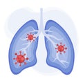 Lungs icon flat style. Human lungs with virus. Virus cells in lung, Infected lungs, Coronavirus, COVID-19. Vector illustration.