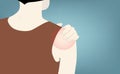 Shoulder pain, a problem of wrong exercise or carry a heavy thing Royalty Free Stock Photo