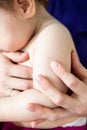 BCG vaccine - mark is on a babyÃ¢â¬â¢s shoulder, close-up view Royalty Free Stock Photo