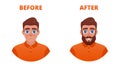 Beard growth concept