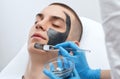 Beautician doing carbon peeling procedure to handsome guy in beauty salon. Hardware male cosmetology