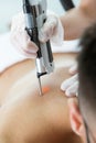 The beautician`s hands removing back hair with a laser to her client in the beauty salon.