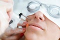 The beautician`s hands removing facial hair with a laser to her client in the beauty salon.