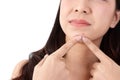 A beautiful Asian woman feels stressed, using fingers to squeeze acne on her cheeks. Royalty Free Stock Photo