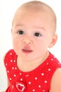Beautiful Baby Girl with Stork Bite on Upper Lip Royalty Free Stock Photo