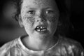A beautiful child with freckles and missing teeth Royalty Free Stock Photo