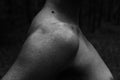 Female clavicles and neck with moles on the skin Royalty Free Stock Photo