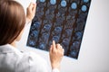 Beautiful female radiologist looking at the MRI scan images Royalty Free Stock Photo