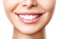 Beautiful female smile after teeth whitening procedure. Dental care. Dentistry concept