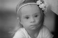 Beautiful girl with Down syndrome on the beach Royalty Free Stock Photo