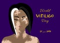 World Vitiligo day poster