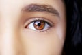 A beautiful insightful look eye with vitiligo. Royalty Free Stock Photo