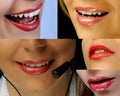 Beautiful lips collage