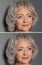 Beautiful mature woman before and after biorevitalization procedure on grey