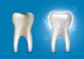 Beautiful realistic dentist vector set of decayed and white shiny cleansed tooth on blue background