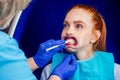 Beautiful redhead ginger woman with open mouth and mouthpiece at the dentist wearing plastic whitening tray