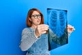 Beautiful redhead woman holding chest radiography clueless and confused expression