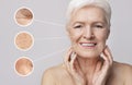 Beautiful senior woman portrait with zoomed zones with skin aging signs Royalty Free Stock Photo