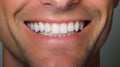 Beautiful smile close up, clean white teeth, male healthy teeth. generative ai