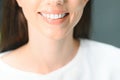 Beautiful Smile With White Teeth. Closeup Of Smiling Woman Mouth With Natural Plump Full Lips And Healthy Perfect Smile