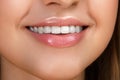Beautiful smile with whitening teeth Royalty Free Stock Photo