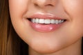 Beautiful smile with whitening teeth Royalty Free Stock Photo