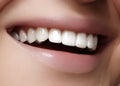 Beautiful smile with whitening teeth. Dental photo. Macro closeup of perfect female mouth, lipscare rutine Royalty Free Stock Photo