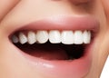 Beautiful smile with whitening teeth. Dental photo. Macro closeup of perfect female mouth, lipscare rutine Royalty Free Stock Photo