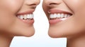 Beautiful smiles with perfect healthy white teeth. Dental health, whitening, prosthetics and care.