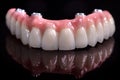 Beautiful upper teeth ceramic press ceramic crowns and veneers on the dental stone model zircon arch ceramic prothesis Implants .