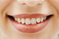 Wide smile of young fresh woman with great healthy white teeth. Closeup of woman smiling with prefect white teeth Royalty Free Stock Photo